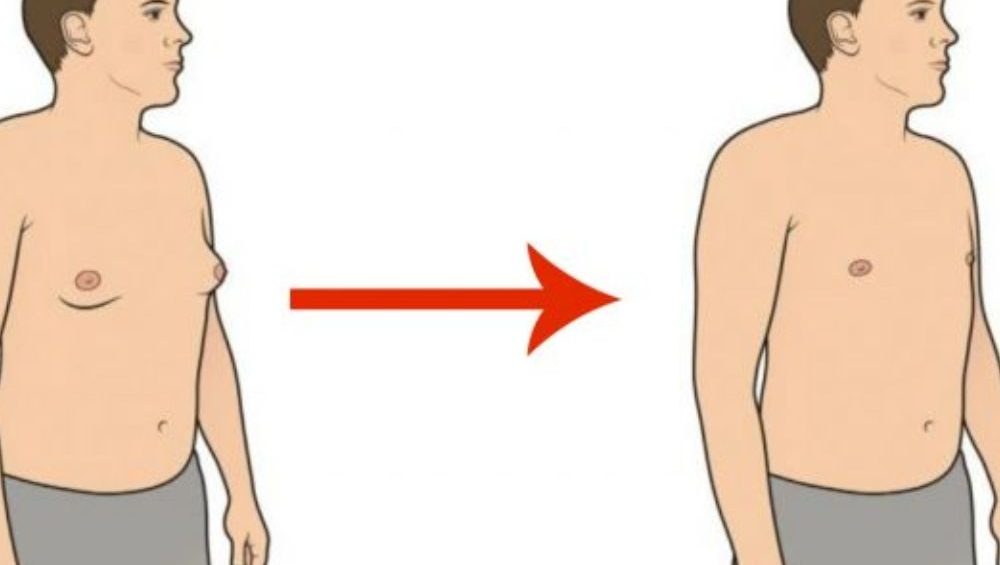Get RID of that saggy chest today!